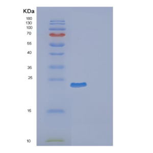 Recombinant Mouse Ephrin-B2 Protein,Recombinant Mouse Ephrin-B2 Protein