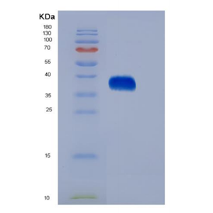 Eukaryotic Erythropoietin (EPO)