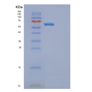 Recombinant Mouse Ephb4 Protein,Recombinant Human TAU Protein