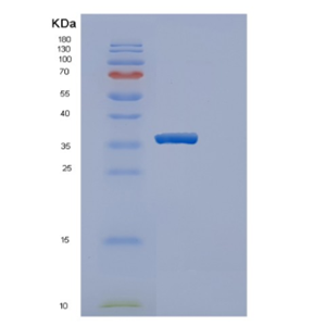 Recombinant Human ERGIC3 Protein,Recombinant Human ERGIC3 Protein