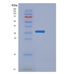 Recombinant Human ERGIC3 Protein