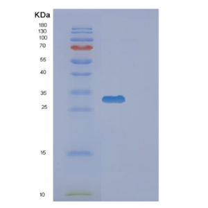 Recombinant Human EXOSC3 Protein,Recombinant Human EXOSC3 Protein