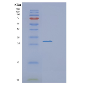 Recombinant Human EXOSC4 Protein,Recombinant Human EXOSC4 Protein