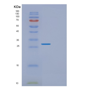 Recombinant Human EXOSC5 Protein