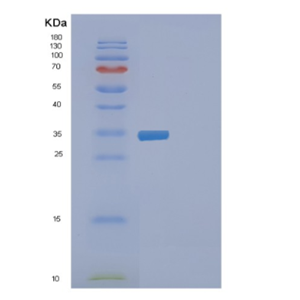 Recombinant Human EXOSC7 Protein