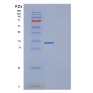 Recombinant Human EYA2 Protein