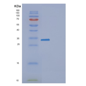 Recombinant Human F2 Protein,Recombinant Human F2 Protein