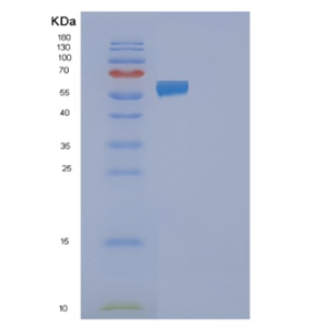 Recombinant Human FAAH2 Protein,Recombinant Human FAAH2 Protein