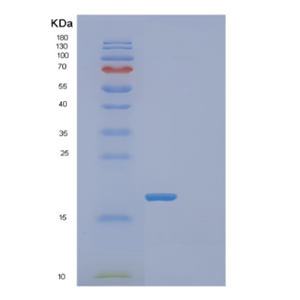 Recombinant Human FABP12 Protein