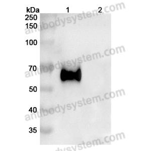 Anti-Human CD333/FGFR3 Antibody (B-701) (FHD52910)