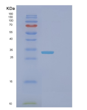 Recombinant Mouse Fcgrt Protein,Recombinant Mouse Fcgrt Protein