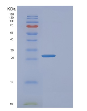 Recombinant Human FADH1 Protein,Recombinant Human FADH1 Protein