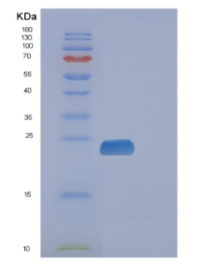 Recombinant Human FAM3C Protein,Recombinant Human FAM3C Protein