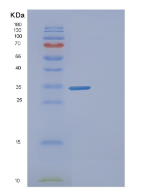 Recombinant Human FAM84A Protein,Recombinant Human FAM84A Protein