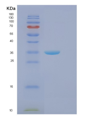 Recombinant Human FBXO2 Protein,Recombinant Human FBXO2 Protein
