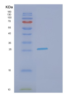 Recombinant Human FCGR3A Protein,Recombinant Human FCGR3A Protein