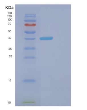 Recombinant Human FGB Protein,Recombinant Human FGB Protein