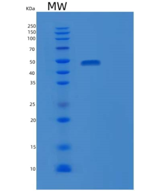 Recombinant Human FGG Protein,Recombinant Human FGG Protein