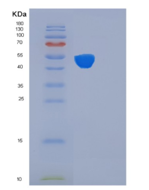 Recombinant Human FKBP4 Protein,Recombinant Human FKBP4 Protein