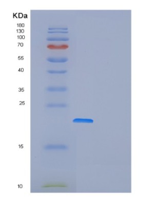 Recombinant Human FOPNL Protein,Recombinant Human FOPNL Protein