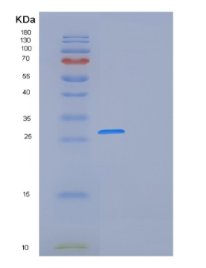 Recombinant Human FOLR1 Protein,Recombinant Human FOLR1 Protein