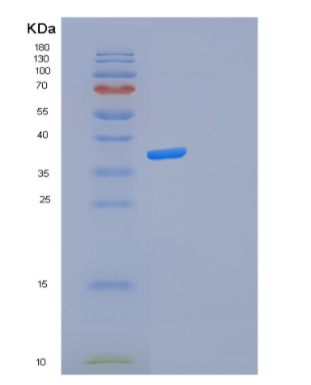 Recombinant Human FOSL2 Protein,Recombinant Human FOSL2 Protein