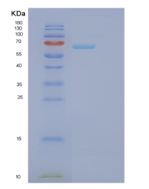 Recombinant Human FARSB Protein,Recombinant Human FARSB Protein