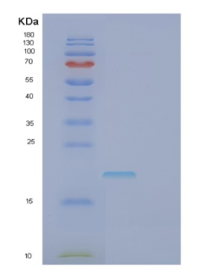 Recombinant Human FASLG Protein,Recombinant Human FASLG Protein