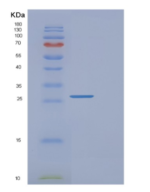 Recombinant Human FAIM Protein,Recombinant Human FAIM Protein