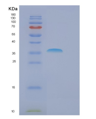 Recombinant Human FBXO6 Protein,Recombinant Human FBXO6 Protein