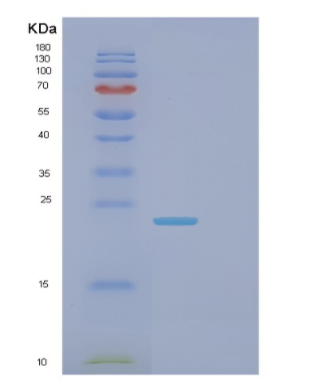 Recombinant Human FCGR2B Protein,Recombinant Human FCGR2B Protein