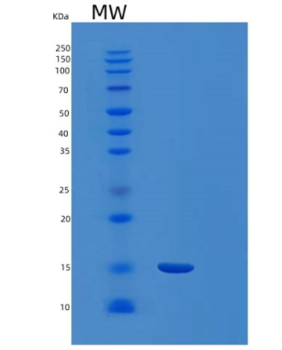 Recombinant Human Ferredoxin 1 Protein,Recombinant Human Ferredoxin 1 Protein