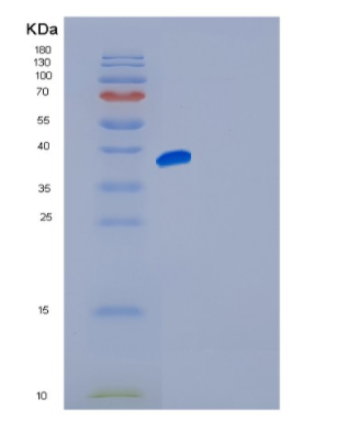 Recombinant Human FGFR4 Protein,Recombinant Human FGFR4 Protein