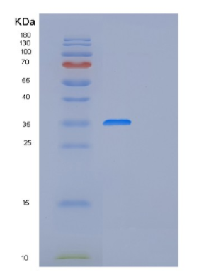 Recombinant Human FRZB Protein,Recombinant Human FRZB Protein