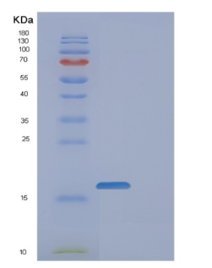 Recombinant Human FAM107B Protein,Recombinant Human TAU Protein