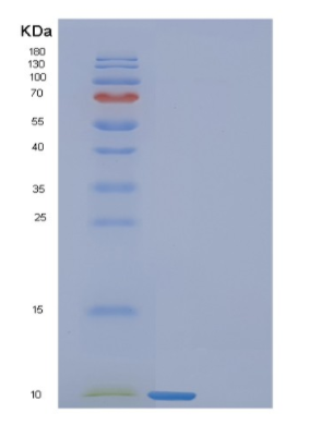 Recombinant Human FANK1 Protein,Recombinant Human FANK1 Protein