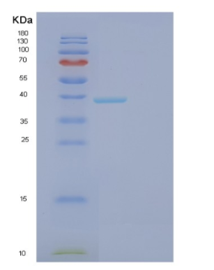 Recombinant Human FBP1 Protein,Recombinant Human FBP1 Protein