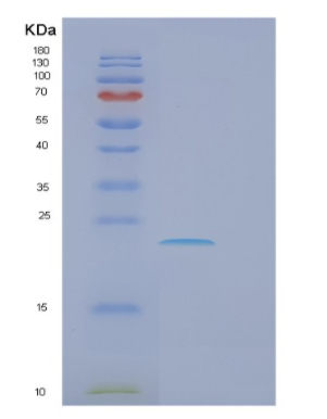 Recombinant Human FCER1A Protein,Recombinant Human FCER1A Protein