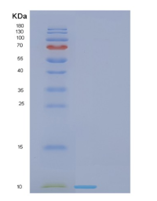 Recombinant Human FDCSP Protein,Recombinant Human FDCSP Protein