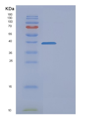 Recombinant Human FAM49B Protein,Recombinant Human FAM49B Protein