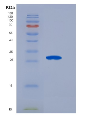 Recombinant Fibroblast Growth Factor 21 (FGF21),Recombinant Fibroblast Growth Factor 21 (FGF21)