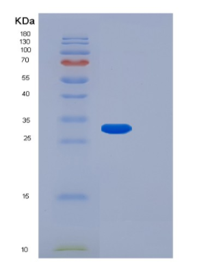 Recombinant Human FGF14 Protein,Recombinant Human FGF14 Protein