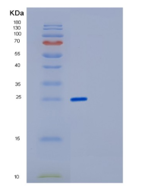 Recombinant Human FKBP3 Protein,Recombinant Human FKBP3 Protein