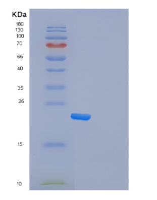 Recombinant Human Frataxin Protein,Recombinant Human Frataxin Protein