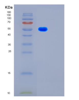 Recombinant Human FSCN1 Protein,Recombinant Human FSCN1 Protein