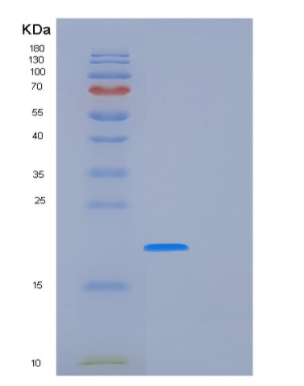 Recombinant Human FUBP1 Protein,Recombinant Human FUBP1 Protein