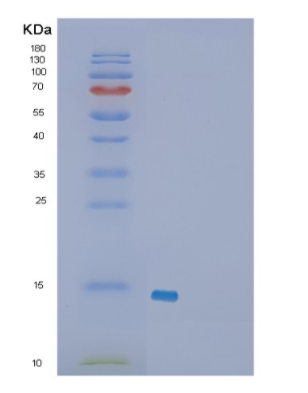 Recombinant Human FKBP2 Protein,Recombinant Human FKBP2 Protein