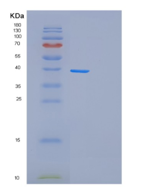 Recombinant Human Fructose-1.6-bisphosphatase 1 Protein,Recombinant Human Fructose-1.6-bisphosphatase 1 Protein