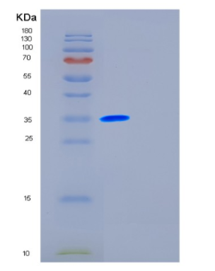 Recombinant Human FSTL1 Protein,Recombinant Human FSTL1 Protein