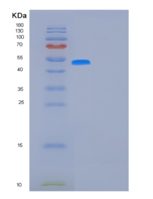 Recombinant Human FUCA1 Protein,Recombinant Human FUCA1 Protein